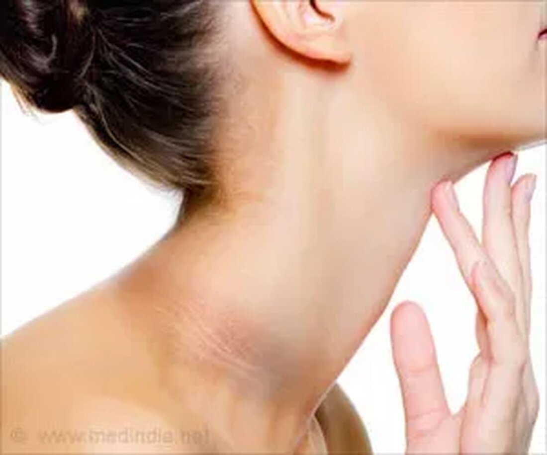 Dunkle Haut um den Hals kann auf eine Störung namens As zurückzuführen sein Acanthosis Nigrikaner. Acanthosis Nigricans ist eine Hauterkrankung, die durch Bereiche mit dunkler, samtiger Hyperpigmentierung der Haut gekennzeichnet ist. Es wird normalerweise in Körperfalten und Falten in den hinteren und seitlichen Falten des Halses, den Achselhöhlen, dem Nabel, der Stirn und anderen Bereichen gefunden. Acanthosis nigricans wird üblicherweise in gutartige und bösartige Formen unterteilt. Gutartig: Dies kann mit Fettleibigkeit, erblichen und endokrinen Formen der Acanthosis nigricans zusammenhängen. Maligne: Dies kann Formen einschließen, die mit Tumorprodukten und insulinähnlicher Aktivität oder Tumornekrosefaktor in Verbindung stehen. Es gibt keine spezifische Behandlung …