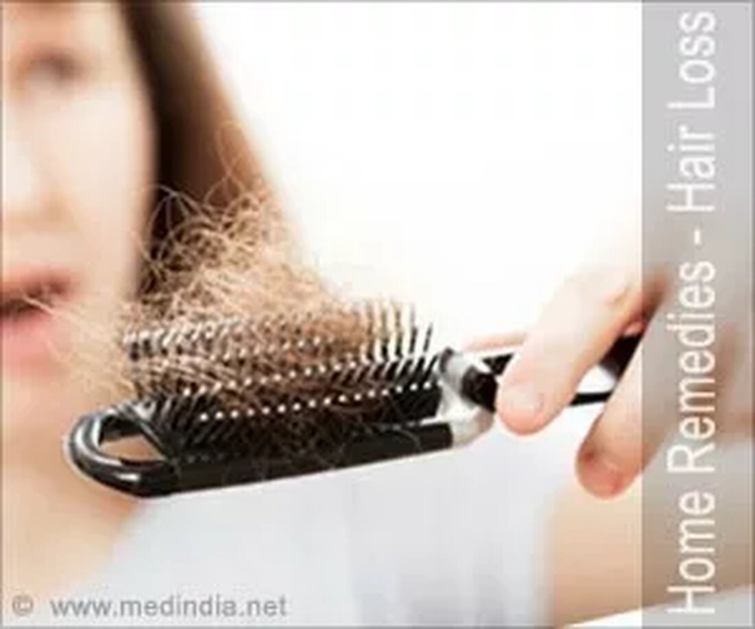 Was ist Haarausfall? Haarausfall ist bei jedem üblich und es ist normal, wenn 50-100 Haarsträhnen pro Tag ausfallen. Haarausfall tritt jedoch auf, wenn häufiger Haarausfall zu einer Ausdünnung der Haare auf der Kopfhaut führt. Schneller Haarausfall kann nicht nur eine Krankheit sein, sondern auch auf Vererbung, Alterung oder Veränderungen der Hormone zurückzuführen sein. Ursachen von Haarausfall: Frisuren: Jeder möchte, dass sein Haar gut aussieht, indem er verschiedene Arten von Frisuren ausprobiert, die stilvoll aussehen können, aber es gibt einige Frisuren, die dazu neigen, das Haar so fest zu ziehen, dass sie Haarausfall verursachen. Kopfhautinfektion: Juckende Kopfhaut kann durch einige Infektionen …
