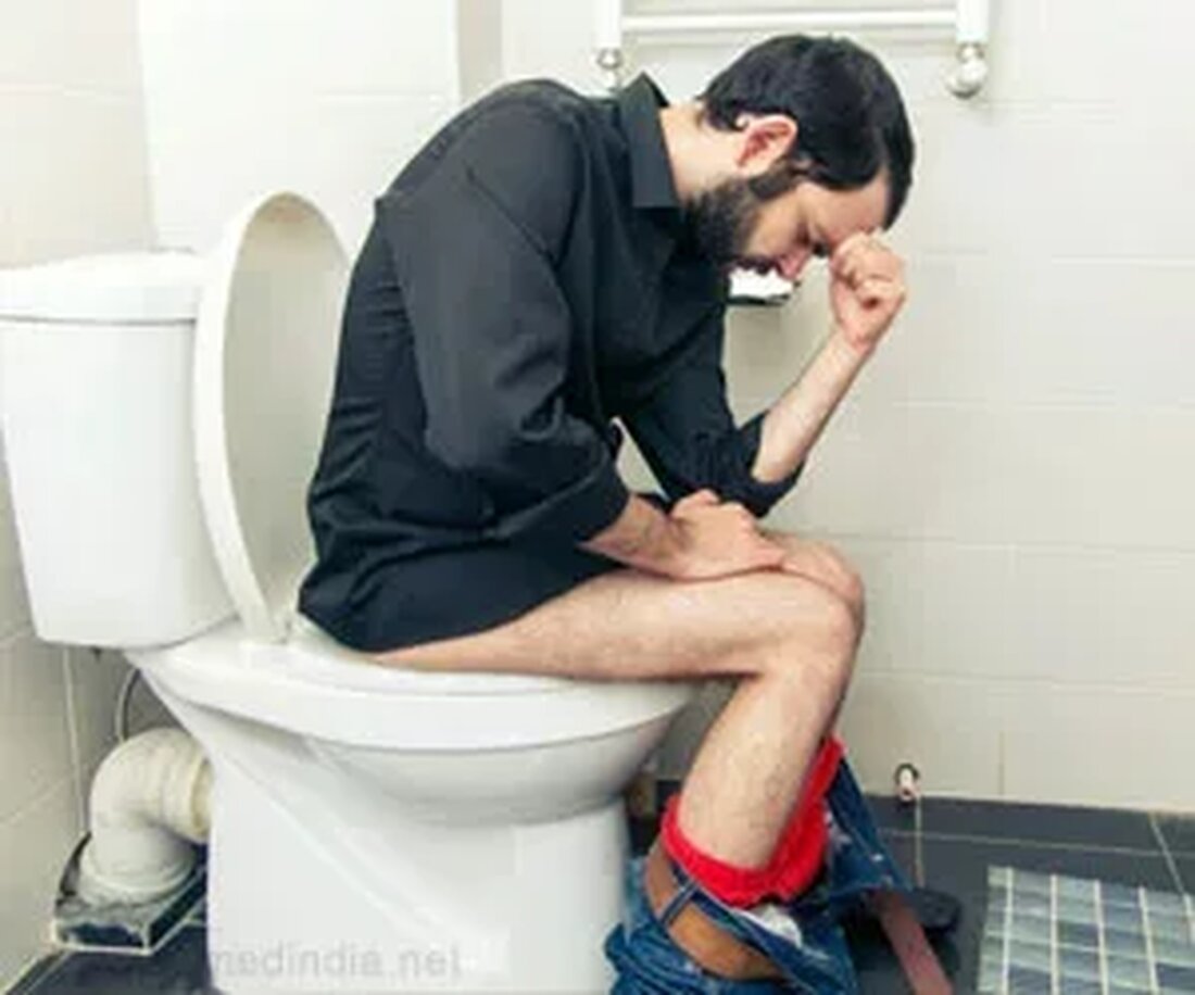 Was sind Pfähle? Hämorrhoiden, auch bekannt als Hämorrhoiden, sind vergrößerte, schmerzhafte Venen im Enddarm. Es bezieht sich auf einen Zustand, bei dem die Venen um den Anus oder das untere Rektum geschwollen und entzündet sind. Hämorrhoiden entstehen durch den erhöhten Druck der inneren oder äußeren Venen rund um den Analkanal. Pfähle sind sowohl intern als auch extern. Innere Hämorrhoiden können, sofern sie nicht schwerwiegend sind, weder gesehen noch gefühlt werden. Äußere Hämorrhoiden können an der Außenseite des Anus gesehen werden. Obwohl es unangenehm und peinlich ist, ist es normalerweise keine ernsthafte Erkrankung. Häufige Ursachen für Pfähle Ballaststoffarme Ernährung Schwangerschaft Altern …
