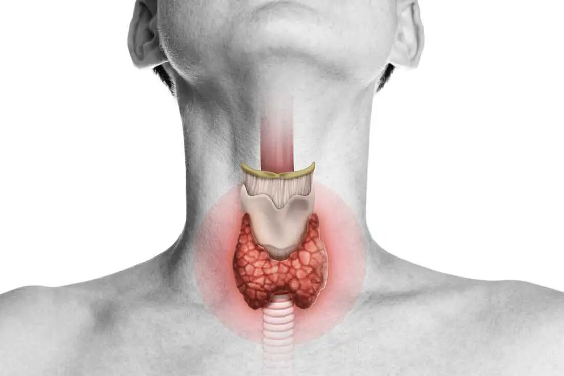 Wenn es um die Erhaltung unserer Gesundheit geht, übersehen wir oft die kleine, schmetterlingsförmige Drüse in unserem Nacken: die Schilddrüse. Dieses leistungsstarke Organ spielt eine wichtige Rolle für den Stoffwechsel, die Regulierung der Körpertemperatur und das allgemeine Wohlbefinden. Es beeinflusst direkt eine Vielzahl von Körpersystemen, vom Magen-Darm-Trakt über das Nervensystem und die Knochen bis hin zum Herzen. @media(min-width:0px){#div-gpt-ad-healthy_holistic_living_com-box-3-0-asloaded{max-width:468px!important;max-height:60px!important;}} Ein erheblicher Prozentsatz der Bevölkerung leidet jedoch unter Schilddrüsenproblemen, die sich in der Regel entweder in einer Unter- oder Überfunktion der Schilddrüse äußern – klinisch als Hypothyreose bzw. Hyperthyreose bezeichnet. Nach Angaben der American Thyroid Association entwickeln mehr als 12 % der …