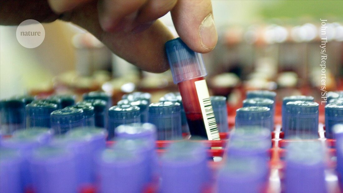 Ein neuartiger Bluttest zur Diagnose von bipolarer Störung sorgt für Aufregung: Während er schnelle Ergebnisse verspricht, äußern Forscher Bedenken zur Validität.