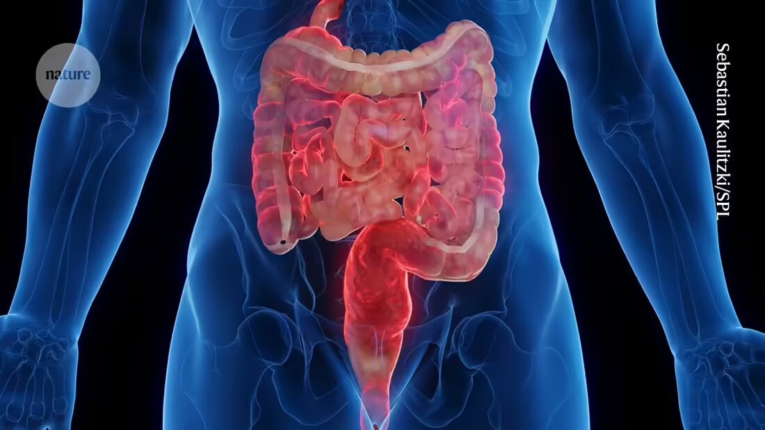 Entdecken Sie die neuesten Forschungsergebnisse zur Behandlung von entzündlichen Darmerkrankungen in diesem Artikel. Erfahren Sie, wie Genetik, Immunreaktionen und Mikroben zusammenwirken und mögliche Behandlungsoptionen für Patienten mit chronischen Darmentzündungen bieten.