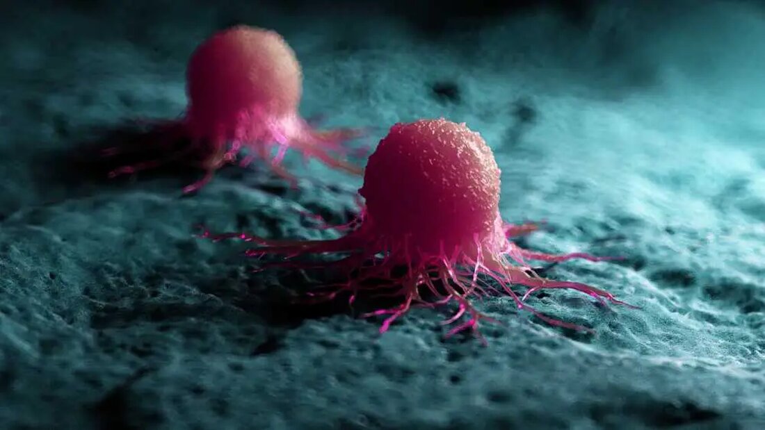 Krebs ist weltweit eine der häufigsten Todesursachen, mit 19,3 Millionen Neuerkrankungen und 10 Millionen Todesfällen allein im Jahr 2020 (International Agency for Research on Cancer, 2020). Da die Weltbevölkerung altert und die Prävalenz von Risikofaktoren wie Rauchen, Fettleibigkeit und Bewegungsmangel zunimmt, wird die Krebslast voraussichtlich weiter steigen. Daher besteht ein dringender Bedarf an innovativen und wirksamen Behandlungen zur Bekämpfung dieser Krankheit. In den letzten Jahren hat die Beziehung zwischen Kollagen, einem im menschlichen Körper vorkommenden Protein, und Krebs in der wissenschaftlichen Gemeinschaft an Aufmerksamkeit gewonnen. Forscher haben entdeckt, dass bestimmte Arten von Kollagen Krebszellen ruhen lassen und verhindern können, dass …