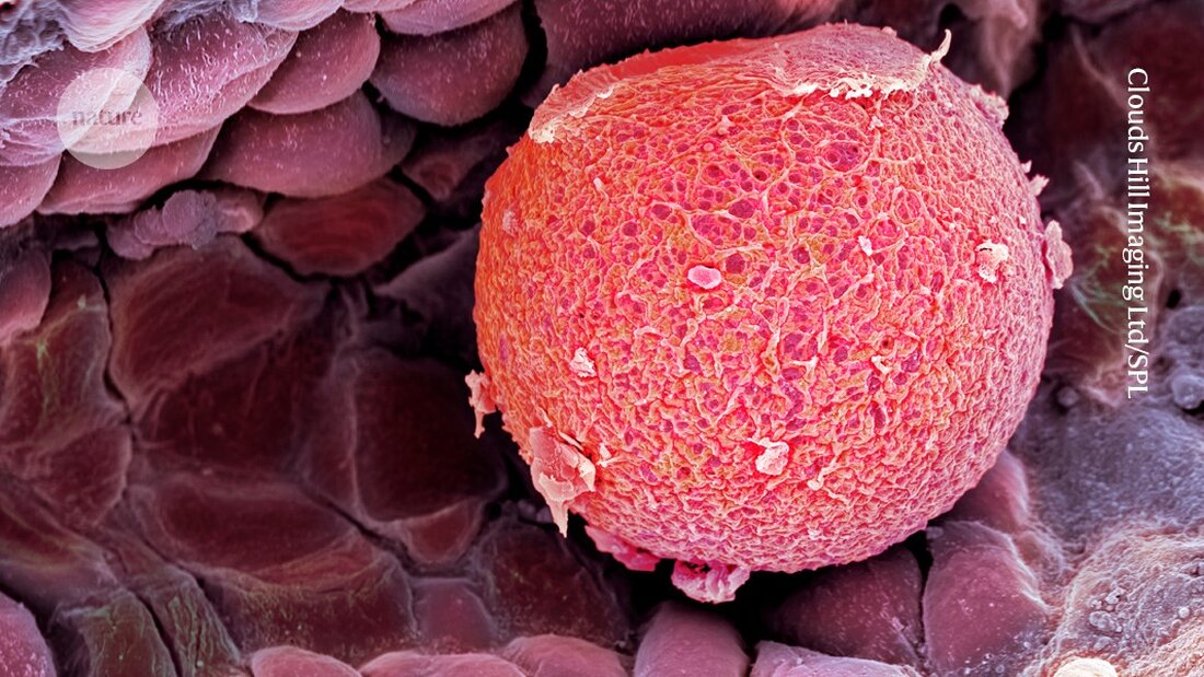Entdecken Sie die neuesten Erkenntnisse aus zwei umfassenden Studien, die über 100.000 Frauen untersuchen und genetische Faktoren identifizieren, die den Beginn der Menopause und die reproduktive Lebensspanne beeinflussen. Diese Forschung bietet vielversprechende Ansätze zur Behandlung von Unfruchtbarkeit und zur Vorhersage des Menopausezeitpunkts. Erfahren Sie mehr über seltene genetische Varianten und deren Einfluss auf das Risiko von Krebs.