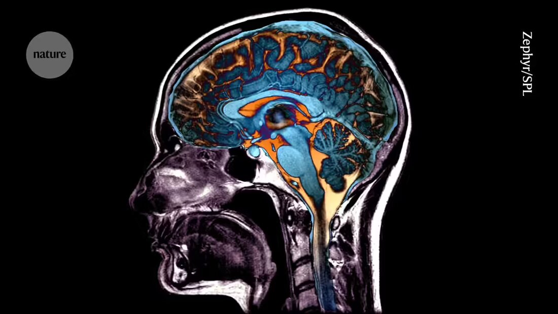 Eine Analyse von fast 50.000 Hirnscans hat fünf verschiedene Muster der Hirnatrophie im Zusammenhang mit Alterung und neurodegenerativen Erkrankungen aufgedeckt. Erfahren Sie, wie diese Muster mit Lebensstilfaktoren, genetischen und gesundheitsbezogenen Markern verbunden sind und wie sie das Verständnis des Alterns vorantreiben können. Entdecken Sie die neuesten Erkenntnisse in der Studie, die in Nature Medicine veröffentlicht wurde.