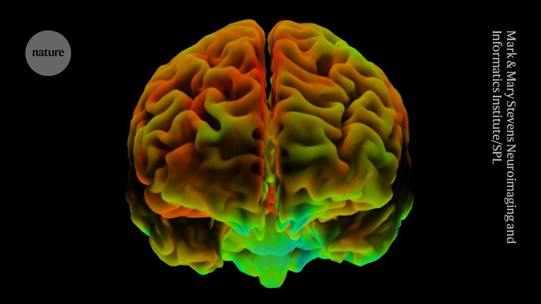 Eine klinische Studie zeigt, dass Heim-basierte Gehirnstimulation bei über 150 Menschen wirksam gegen Depressionen sein kann.