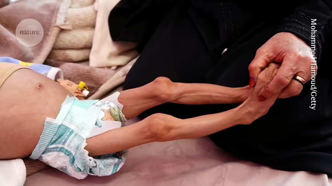Eine Studie zeigt, dass Menschen, die im Mutterleib extremer Hungersnot ausgesetzt waren, als Erwachsene mehr als doppelt so wahrscheinlich an Diabetes leiden. Erfahren Sie mehr über die langfristigen Auswirkungen von Hungersnöten während der Schwangerschaft und die spezifischen Risikoperioden für ungeborene Babys.