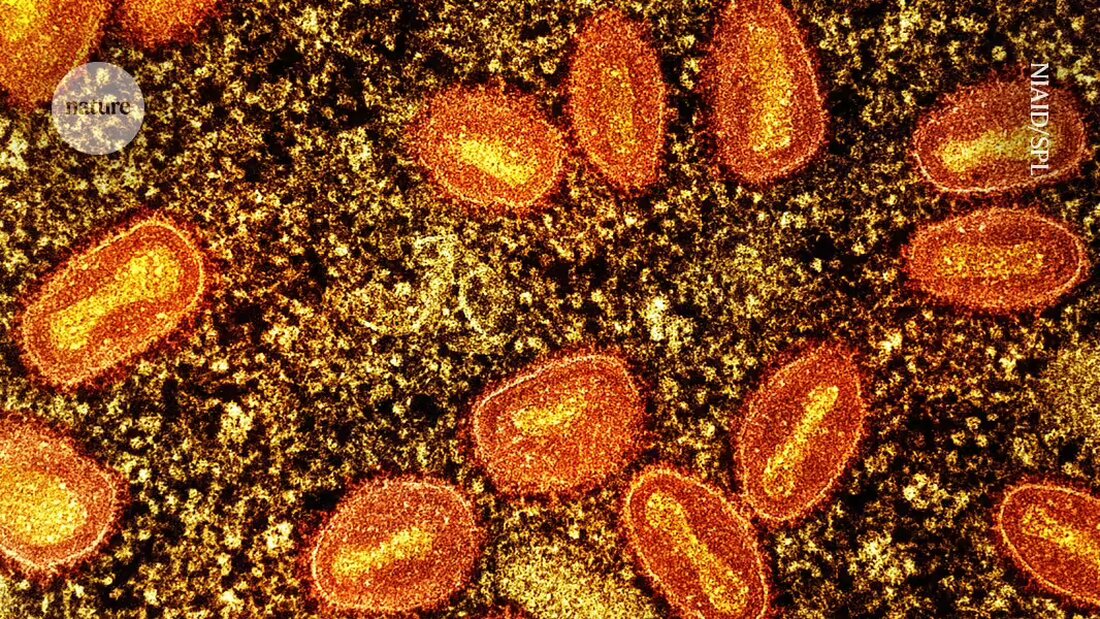 Erfahren Sie mehr über den aktuellen Ausbruch von Mpox-Viren und die damit verbundenen gesundheitlichen Bedenken, einschließlich der Ausbreitung des Virus auf neue afrikanische Länder und die Wirksamkeit von Impfstoffen gegen diese gefährliche Krankheit. Nature bietet Einblicke von Forschern, die eifrig daran arbeiten, Informationen zu sammeln, um die Auswirkungen dieses Ausbruchs einzudämmen.