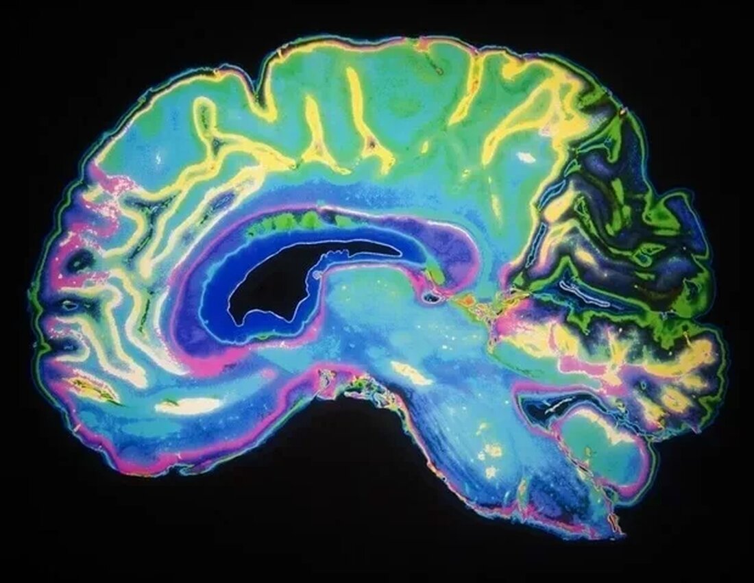 Veränderungen in der Gehirnaktivität nach Achtsamkeitstraining identifiziert Eine Studie des Center for Healthy Minds an der University of Wisconsin-Madison hat Veränderungen in der schmerzbezogenen Gehirnaktivität nach Achtsamkeitstraining isoliert. Diese Erkenntnisse weisen den Weg zu gezielteren und präziseren Schmerzbehandlungen. Die Studie, die am 27. Juli im American Journal of Psychiatry veröffentlicht wurde, identifizierte spezifische Gehirnwege zur Schmerzregulation, deren Aktivität durch den achtwöchigen Kurs zur Stressreduktion durch Achtsamkeit des Centers verändert wird. Diese Veränderungen waren nicht bei Teilnehmern zu beobachten, die einen ähnlichen Kurs ohne Achtsamkeitsanleitung besuchten. Laut Joseph Wielgosz, der die Studie leitete, sind dies wichtige neue Erkenntnisse, die belegen, dass …