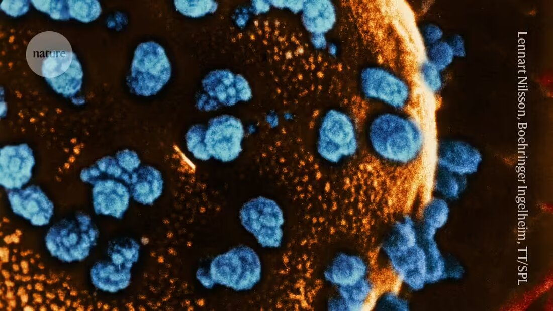 Eine 25-jährige Frau mit Typ-1-Diabetes produzierte nach einer Stammzelltransplantation eigenständig Insulin — ein bahnbrechender Erfolg.