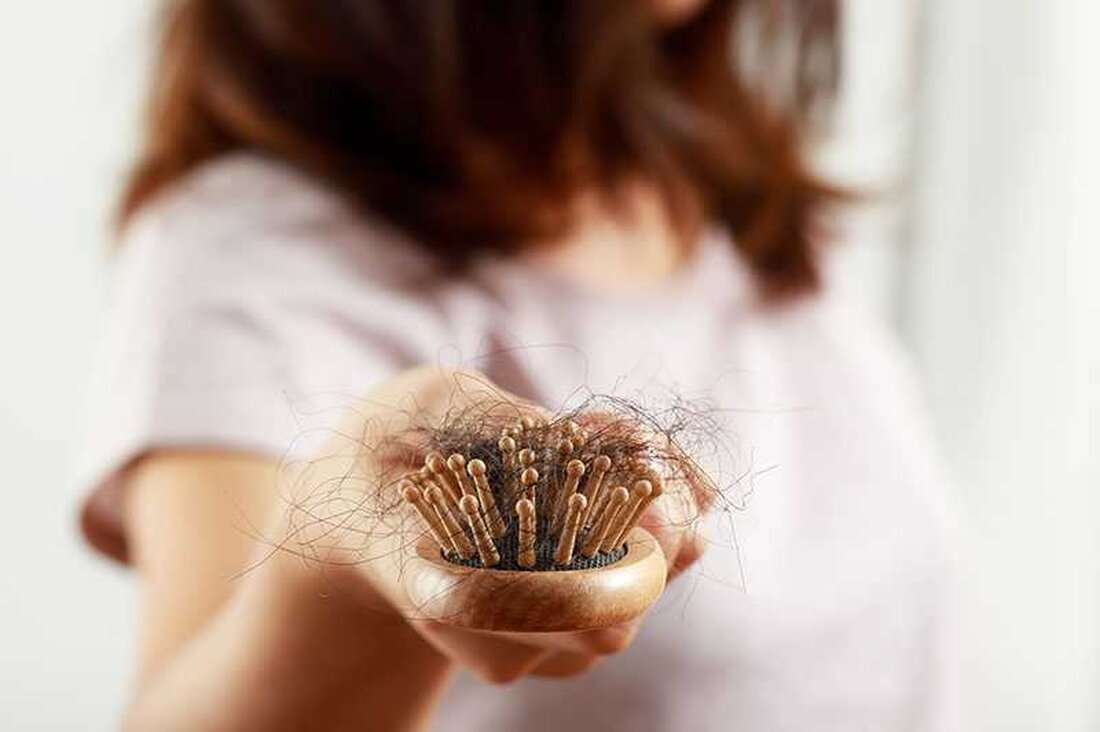 Haarausfall ist ein weit verbreitetes Problem, wobei fast 80 % der Männer und die Hälfte aller Frauen im Laufe ihres Lebens von Haarausfall betroffen sind. Es kann durch eine Vielzahl von Faktoren wie Genetik, Alterung, hormonelle Ungleichgewichte, Stress und bestimmte Erkrankungen verursacht werden. Während Nahrungsergänzungsmittel häufig zur Behandlung von Haarausfall eingesetzt werden, gibt es nur begrenzte Daten zu ihrer Wirksamkeit und Sicherheit. Arten von Haarausfall Die häufigste Form des Haarausfalls ist die androgenetische Alopezie, die auch als Kahlköpfigkeit bei Männern oder Kahlheit bei Frauen bekannt ist. Diese Art von Haarausfall wird durch einen Anstieg des Hormons Dihydrotestosteron (DHT) verursacht, das …