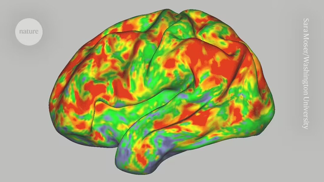 Erfahren Sie mehr über wissenschaftliche Artikel und Referenzen von Siegel, J.S., Carhart-Harris, R. und Barrett, F., die in renommierten Magazinen wie Nature und PNAS veröffentlicht wurden. Lese die Artikel und finde weitere Informationen auf Google Scholar und PubMed.