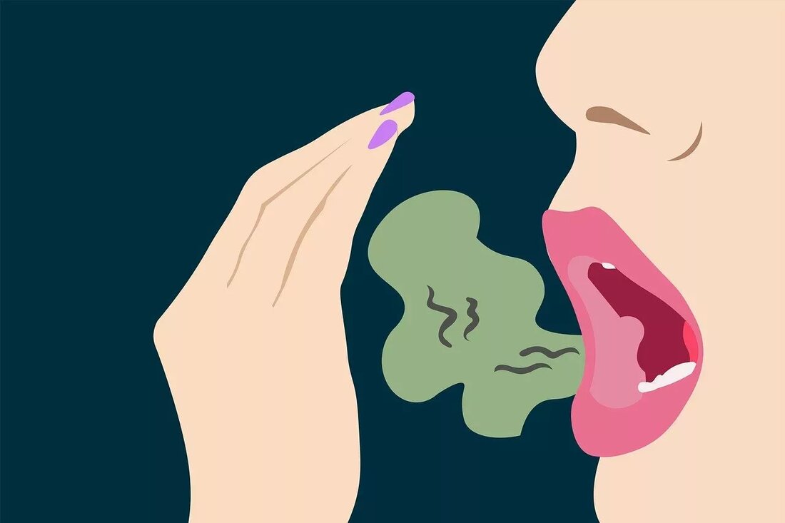 Es gibt viele Ursachen für Mundgeruch, auch Halitosis genannt. Ihr Mund kann die Ursache sein. Der Abbau von Speiseresten und anderen Ablagerungen durch Bakterien in und um Ihre Zähne kann einen üblen Geruch verursachen. Wenn Ihr Mund trocken ist, z. B. während des Schlafs oder nach dem Rauchen, können sich abgestorbene Zellen auf Ihrer Zunge, Ihrem Zahnfleisch und Ihren Wangen ansammeln und zersetzen, was den Geruch verursacht. Der Verzehr von Lebensmitteln, die stark riechende Öle enthalten, wie Zwiebeln und Knoblauch, kann zu Mundgeruch führen. Schlecht riechender Atem kann auch ein Symptom einer Krankheit sein, z. B. einer Lungenerkrankung, Diabetes oder …