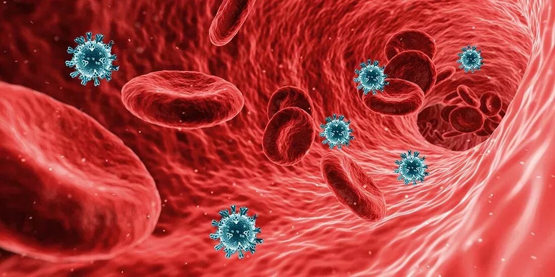 Alle systemische Wirkungen von COVID-19 Nach nur wenigen Tagen Betreuung kritisch kranker COVID-19-Patienten zu Beginn des Ausbruchs in New York City erkannte Dr. Aakriti Gupta, dass dies weit mehr als eine Atemwegserkrankung war. „Von Anfang an an vorderster Front …“ „Ich war von Anfang an an vorderster Front. Ich habe beobachtet, dass das Blut der Patienten oft geronnen war, sie einen hohen Blutzucker hatten, auch wenn sie keinen Diabetes hatten und viele hatten eine Beeinträchtigung ihrer Herzen und Nieren “, sagt Gupta, einer der ersten Columbia-Kardiologen, die für das COVID eingesetzt wurden Intensivstationen am Irving Medical Center der Columbia University. …