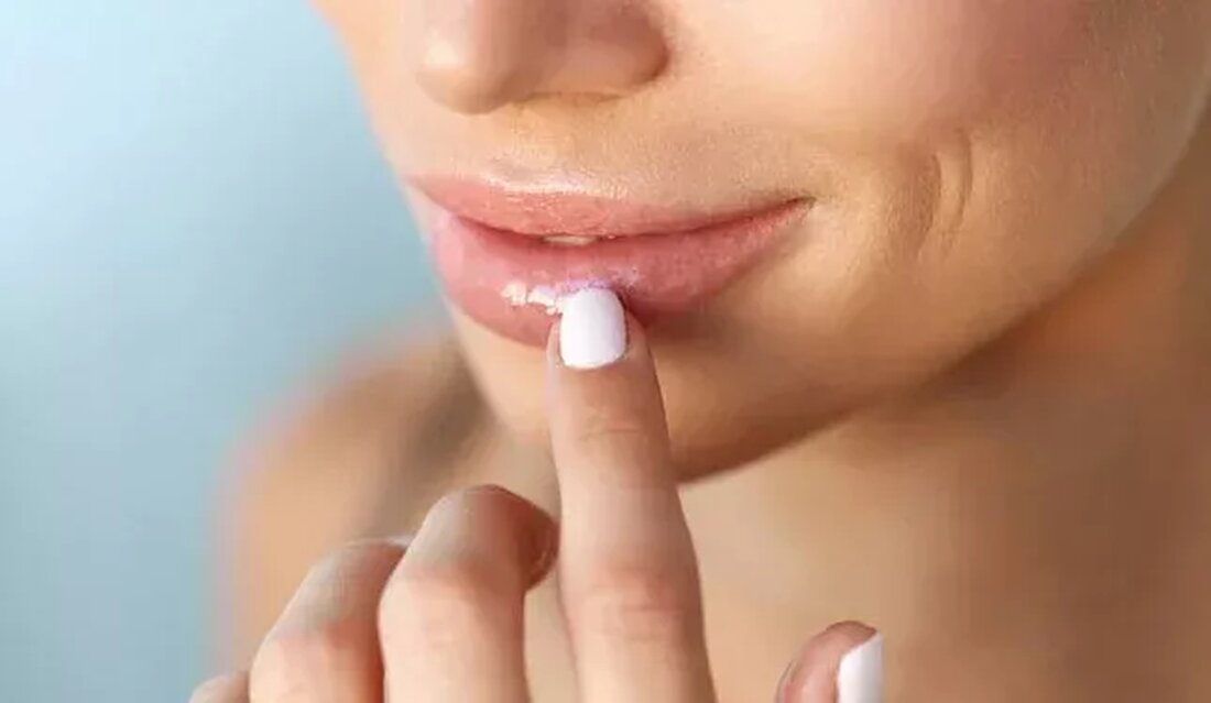 Sie fragen sich, warum Ihre Lippen plötzlich nicht mehr so rosa sind wie früher und von Tag zu Tag dunkler werden? Keine Sorge, Sie sind nicht allein. Wenn es nicht genetisch bedingt ist, können verschiedene Gesundheits-, Ernährungs- und Lebensstilfaktoren Ihre Lippen dunkel färben. Wenn Sie rauchen, haben Sie möglicherweise dunklere Lippen als Ihre nicht rauchenden Freunde. Manchmal enthalten Kosmetika auch Chemikalien, die Ihre Lippen dunkel färben können. Auch ein Vitaminmangel kann zu Lippenverfärbungen führen. Achten Sie auf eine gesunde Ernährung und essen Sie viel Obst und Gemüse, das reich an Vitamin C ist, um dunkle Lippen loszuwerden. Es ist auch …