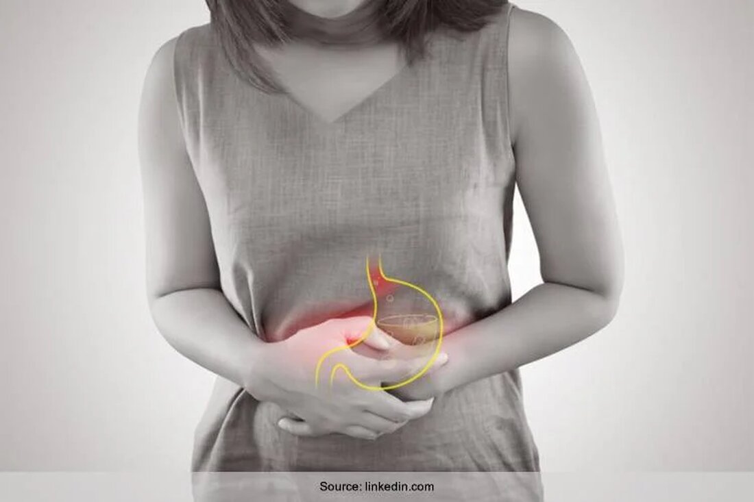 Hier finden Sie die gängigsten Hausmittel gegen Gastritis. Auch wenn es manchmal schwierig ist das richtige Hausmittel zu finden, so ist es doch manchmal gar nicht so weit entfernt. Die meisten Hausmittel haben Sie bereits in Ihrem Haushalt, wie der Name es schon vermuten lässt. Gastritis ist eine Erkrankung, die die Magenschleimhaut einer Person betrifft und eine Entzündung verursacht. Eine Person kann Hausmittel anwenden oder Änderungen im Lebensstil vornehmen, die einige Symptome lindern können. Abhängig von der Ursache kann eine Person auch eine medizinische Behandlung benötigen. Gastritis beschreibt jeden Zustand, der die Magenschleimhaut entzündet. Helicobacter pylori-Bakterien, eine Bakterienart, die Magen …