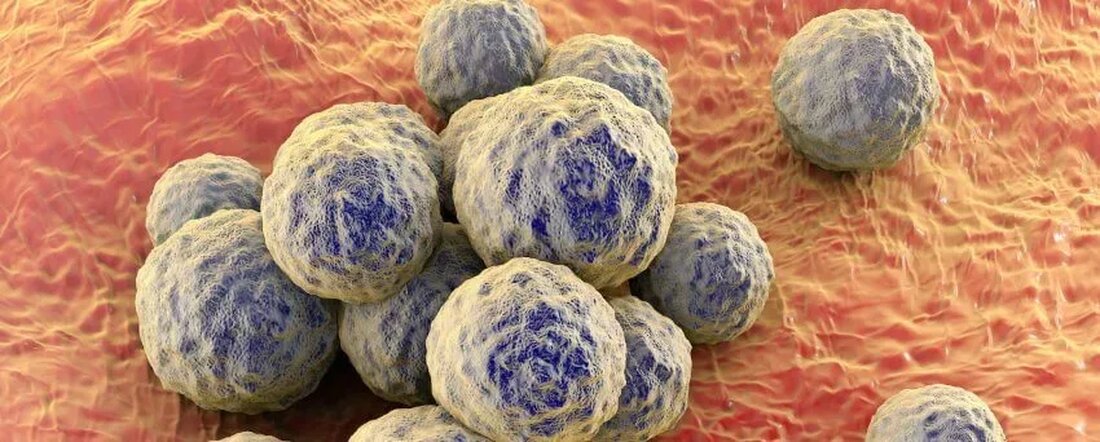 Fast 20.000 Deutsche sterben jedes Jahr an Komplikationen, die auf Methicillin-resistenten Staphylococcus aureus oder besser bekannt als MRSA zurückzuführen sind. ((Link entfernt)) Dieser „Super Staph“ hat viel Medienberichterstattung erhalten und ist aus gutem Grund beängstigend. Eine regelmäßige Staphylokokkeninfektion ist nicht besonders gefährlich oder schwer zu behandeln. Tatsächlich ist es für einen gesunden Menschen völlig normal, dass zu einem bestimmten Zeitpunkt einige Staphylococcus-Bakterien auf der Haut oder in der Nasenhöhle leben. Das einzige Mal, wenn es zu einem ernsthaften Problem wird, ist, wenn es irgendwie in der Lage ist, durch eine Öffnung wie einen Schnitt oder einen chirurgischen Schnitt in die Haut einzudringen. …