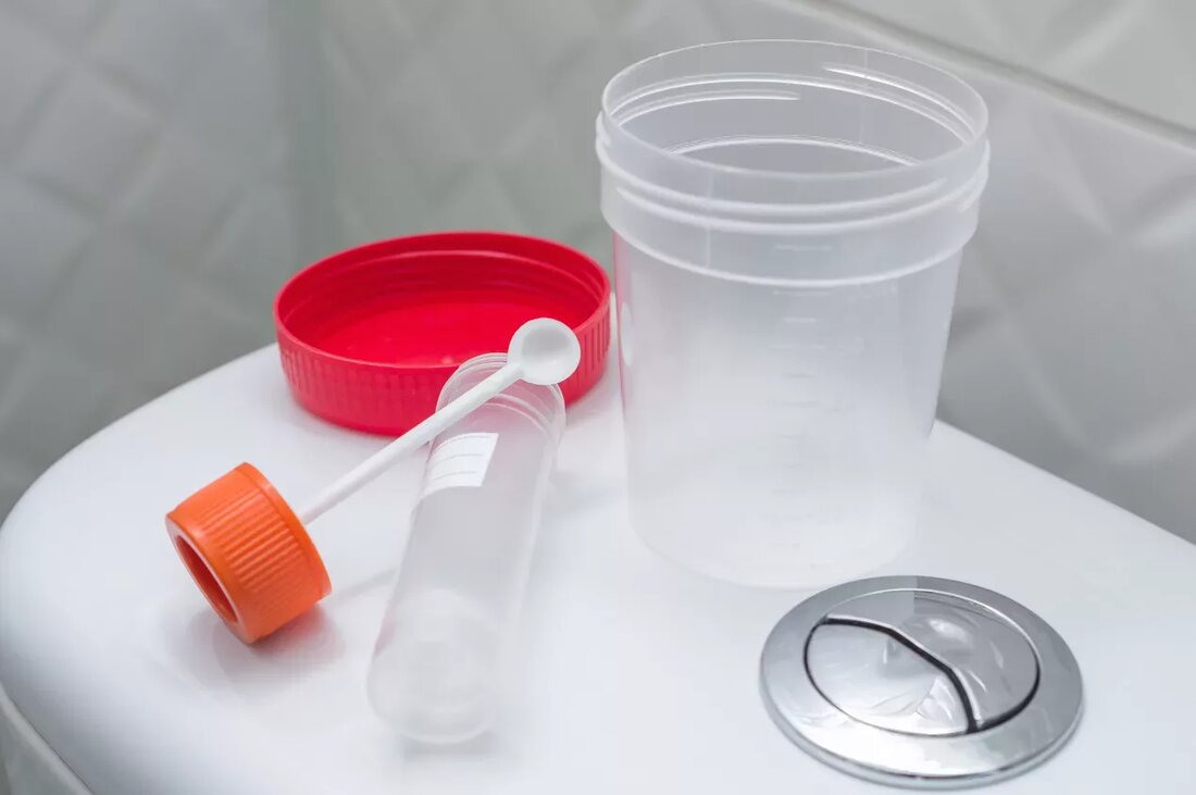 Medizinische Diagnostik ist eines der wichtigsten Elemente einer umfassenden Beurteilung des Gesundheitszustands eines Patienten, und die durch entsprechende Untersuchungen ermittelten Ergebnisse helfen bei der Auswahl der effizientesten Therapiemethoden. Kein Probenahmelabor könnte ohne spezielle Behälter zur Aufbewahrung von Proben funktionieren Zu den notwendigsten Hilfsmitteln dieser Art gehören Urinprobe- und Stuhlbehälter sowie Blutabnahmeröhrchen. Wodurch sollten Urinprobe – und Stuhlbehälter gekennzeichnet sein? Zuverlässige Tests erfordern die strikte Einhaltung der geltenden Verfahren und vor allem die Verwendung geeigneter Ausstattung bereits bei der Probenahme. Die erzielten Ergebnisse dürfen nicht durch das Vorhandensein von Fremdkörpern, die die ermittelten Ergebnisse direkt beeinflussen. beeinträchtigt werden. Es ist besonders wichtig, die Proben vor …