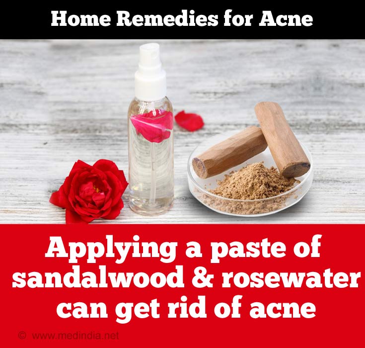 Sandelholz und Rosenwasser können Akne loswerden