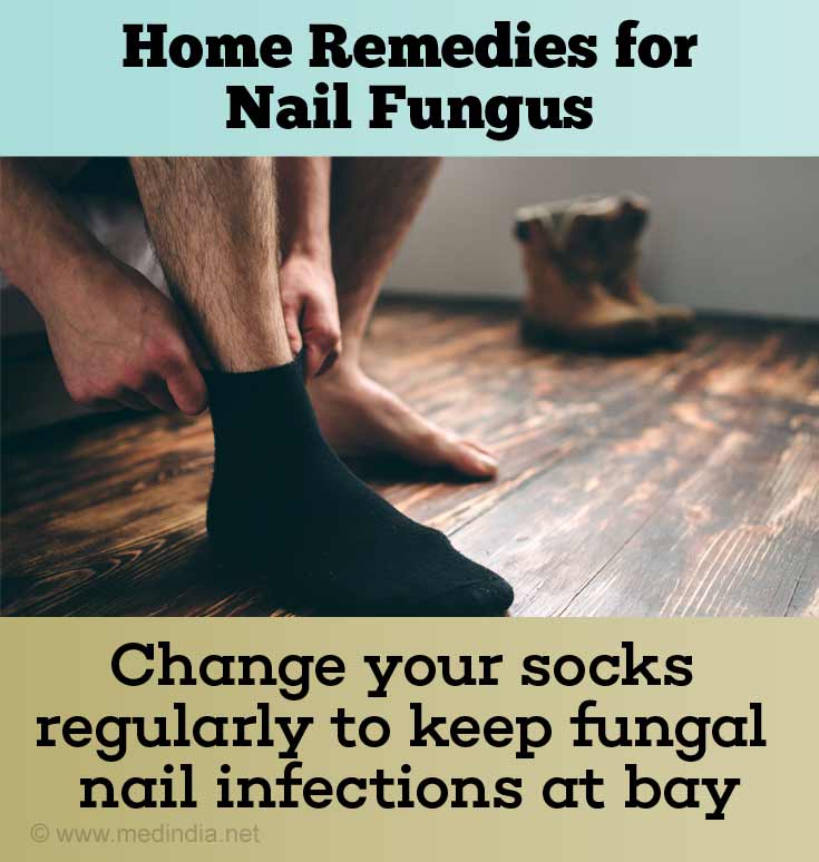 Wechseln Sie Ihre Socken regelmäßig, um Nagelpilzinfektionen vorzubeugen
