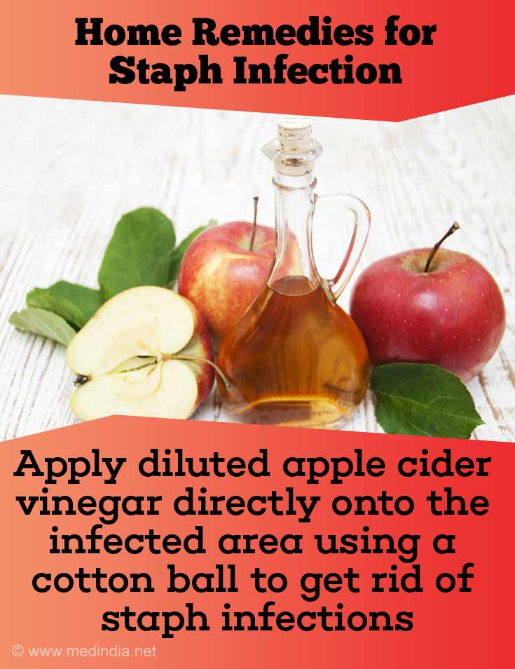 Apfelessig kann Staph-Infektion heilen 