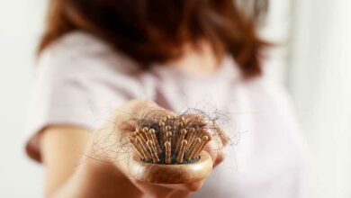 Welche-Nahrungsergaenzungsmittel-eignen-sich-am-besten-zur-Behandlung-von-Haarausfall