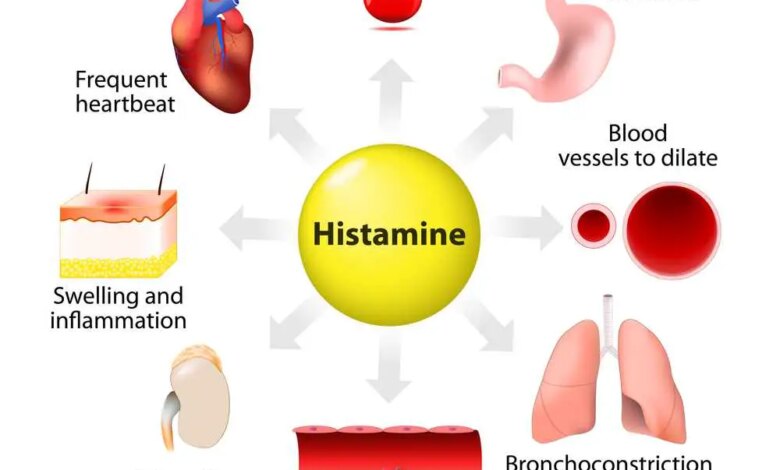 Histaminintoleranz-Das-Ungleichgewicht-hinter-verstopfter-Nase-Angst-und-Kopfschmerzen