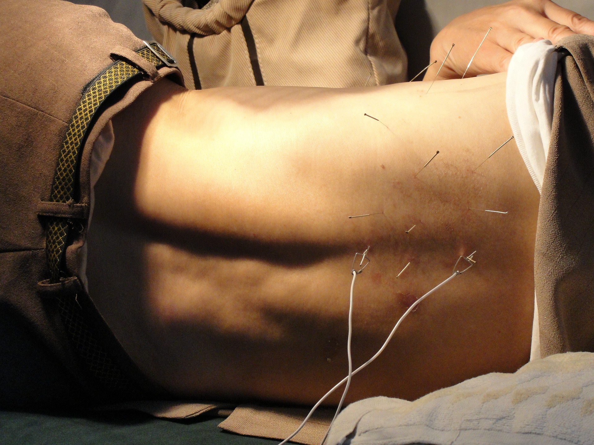 Akupunktur ist bei einigen Bedingungen wirksam, insbesondere bei verschiedenen Arten von Schmerzen
