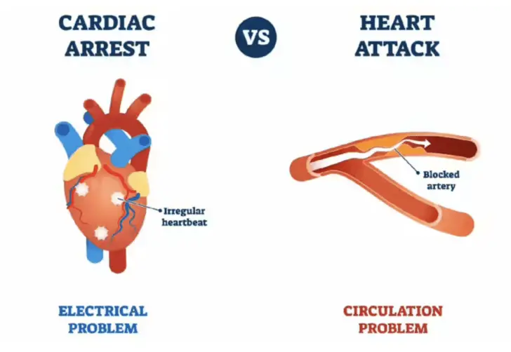 Was ist der Unterschied zwischen Herzstillstand und Herzinfarkt Naturheilkunde