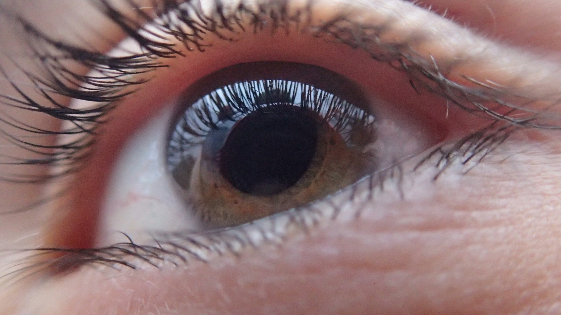 Der Glaskörper ist eines der wichtigsten Teile des Auges