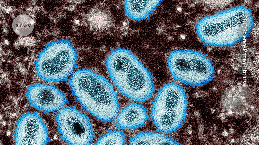 Affenpocken-Virus verbessert sich zunehmend in der menschlichen Übertragung