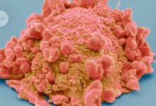 Ultra-precise 3D maps of cancer cells unlock secrets of how tumours grow