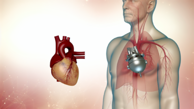 Enhancement to effusion: Breast implant-associated anaplastic large cell lymphoma.