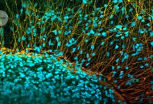 Paralysed man stands again after receiving ‘reprogrammed’ stem cells